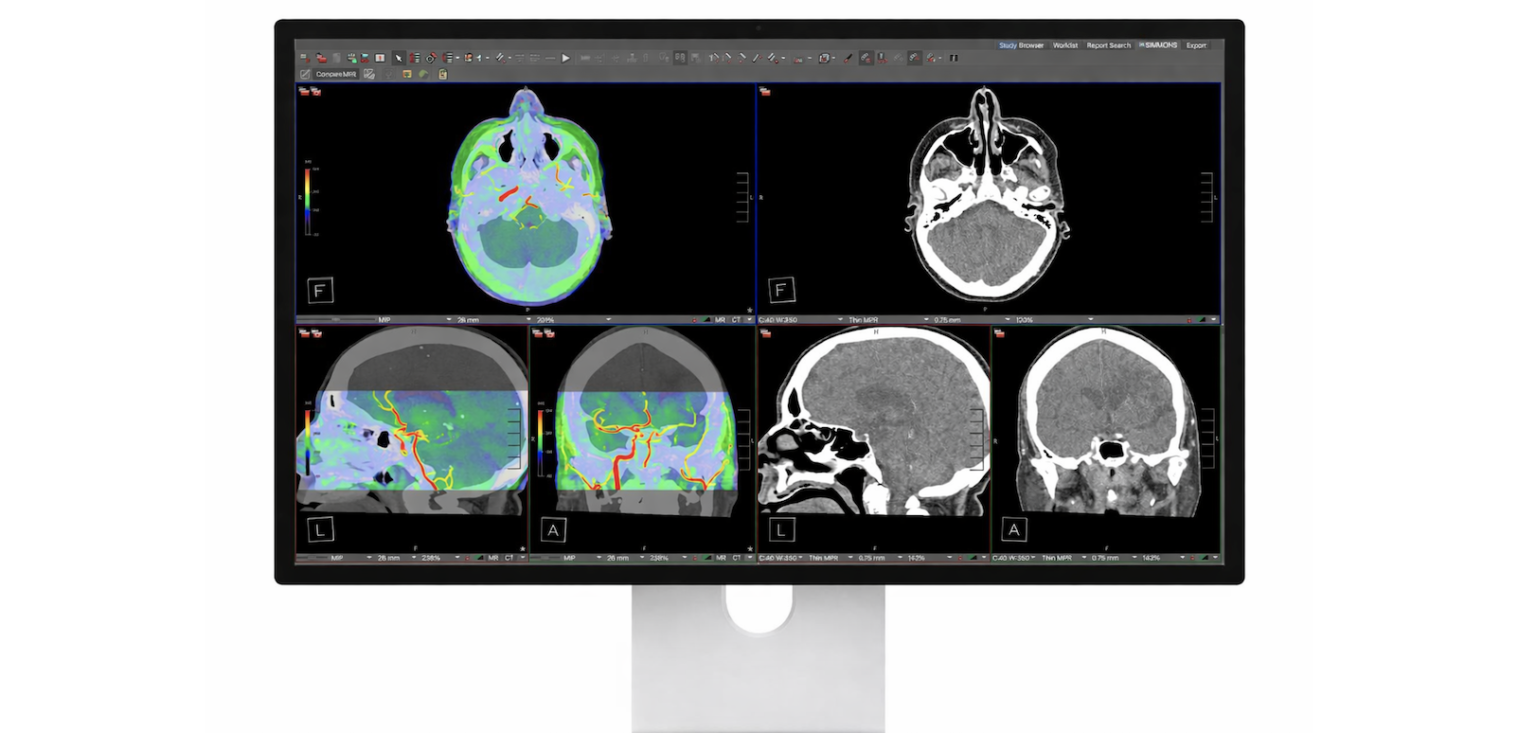 Apple Studio Display XDR with DICOM Support for Radiology