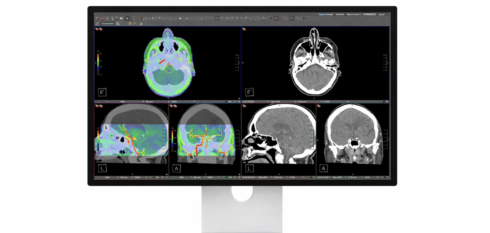 Apple Studio Display XDR Elevates Diagnostic Radiology with DICOM Support